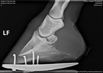 X-ray image 1 (full rocker)