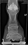 X-ray image 2 (full rocker)