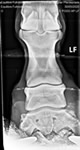 X-ray image 4 (full rocker)