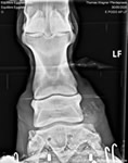 X-ray image 4 (Eggplate new)